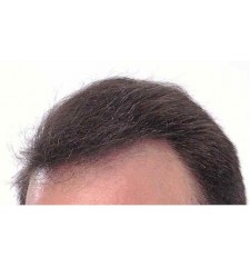 DermMatch Concealer - Kaschiert dünnes Haar